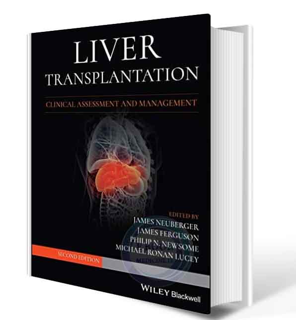 دانلود کتاب  Liver Transplantation: Clinical Assessment and Management 2nd  2021  (ORIGINAL PDF)  